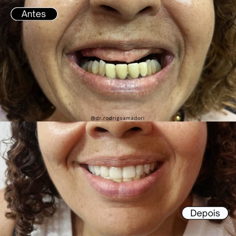 servico realizado implante dentario 1